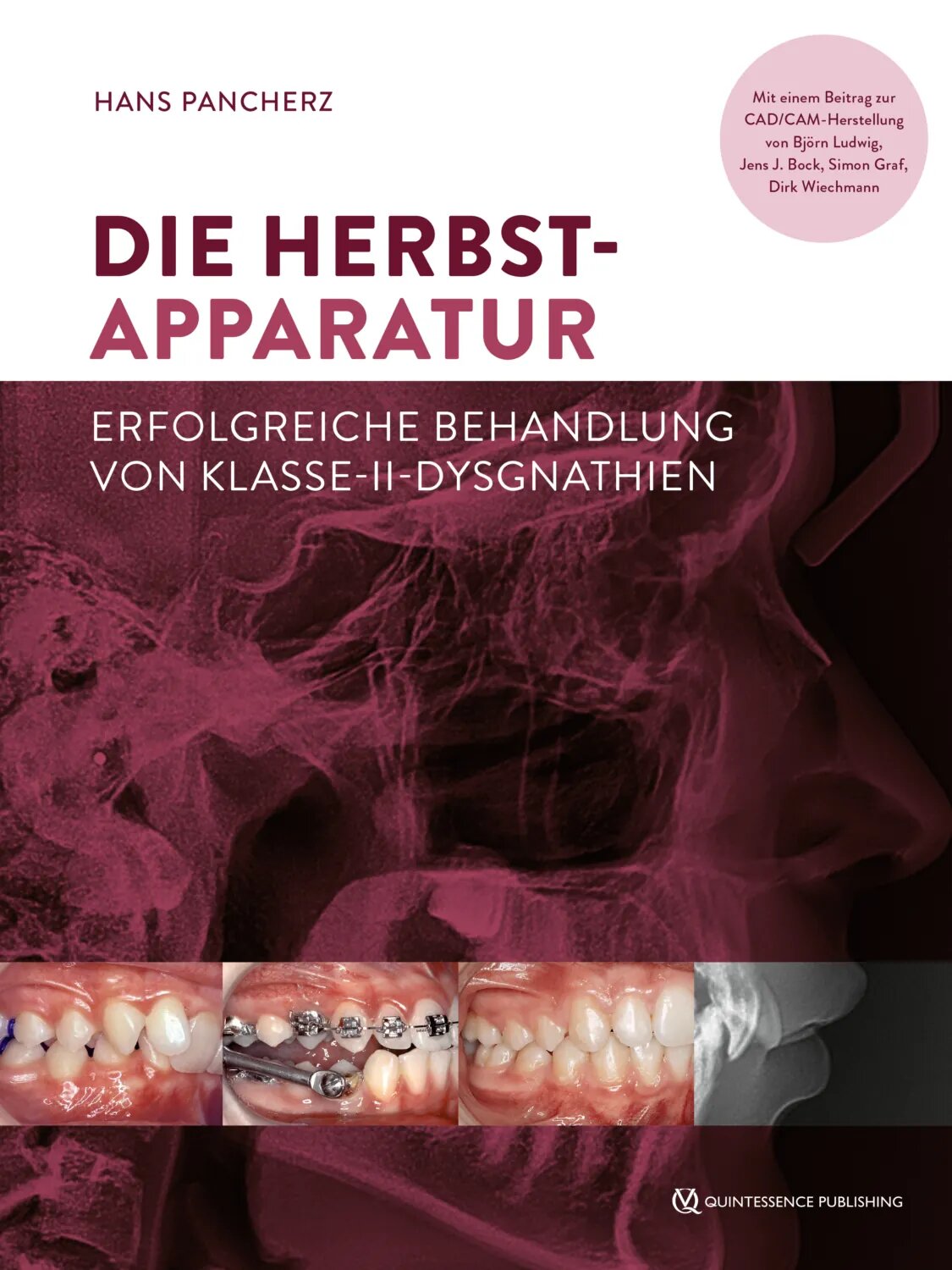 Die Herbst-Apparatur [Цифровая книга]