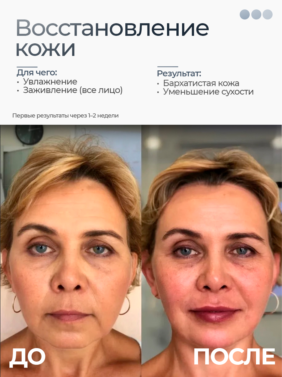 Картинки Микротоковый массажер с вибрацией для лица и шеи, для тела EMS-массажер