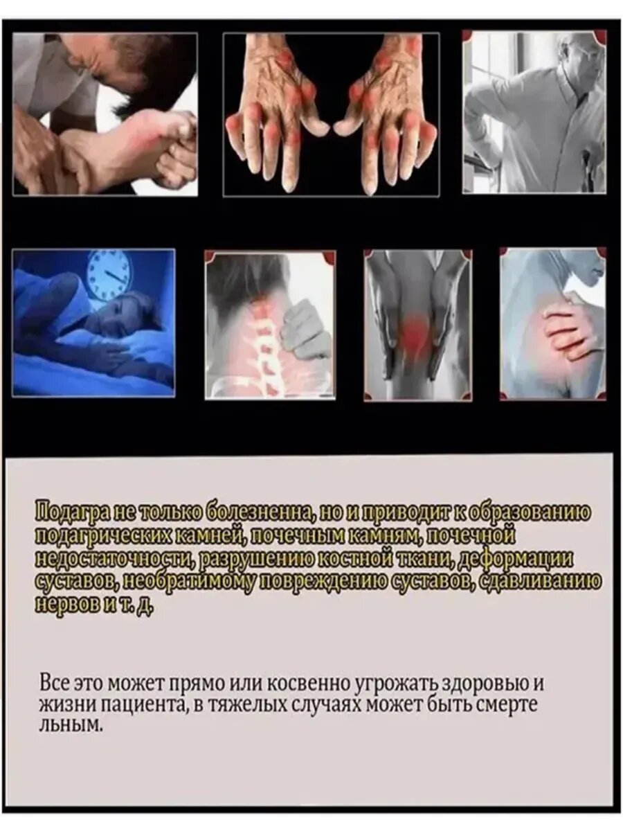 Картинки Пластырь от подагры для стопы，8 шт.