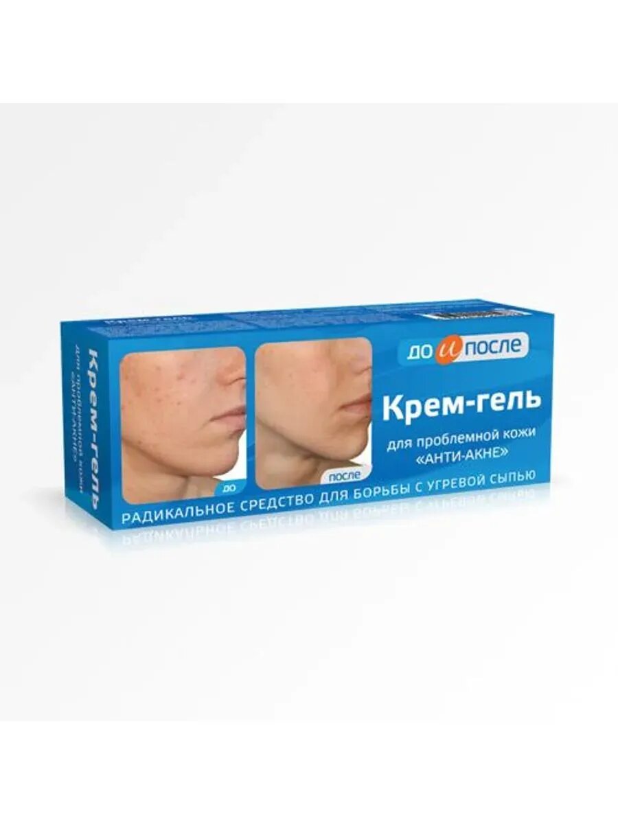 Крем-гель анти-акне 50 мл