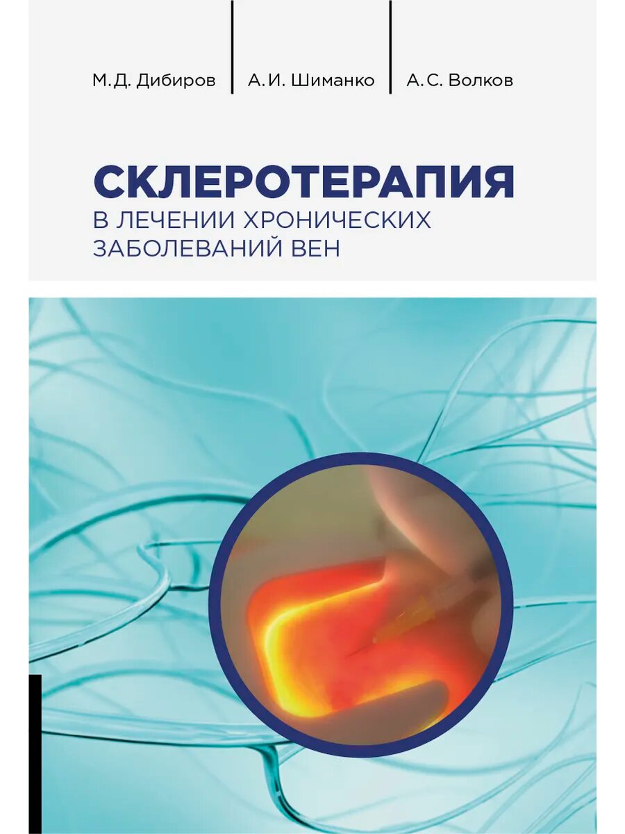 Склеротерапия в лечении хронических заболеваний вен