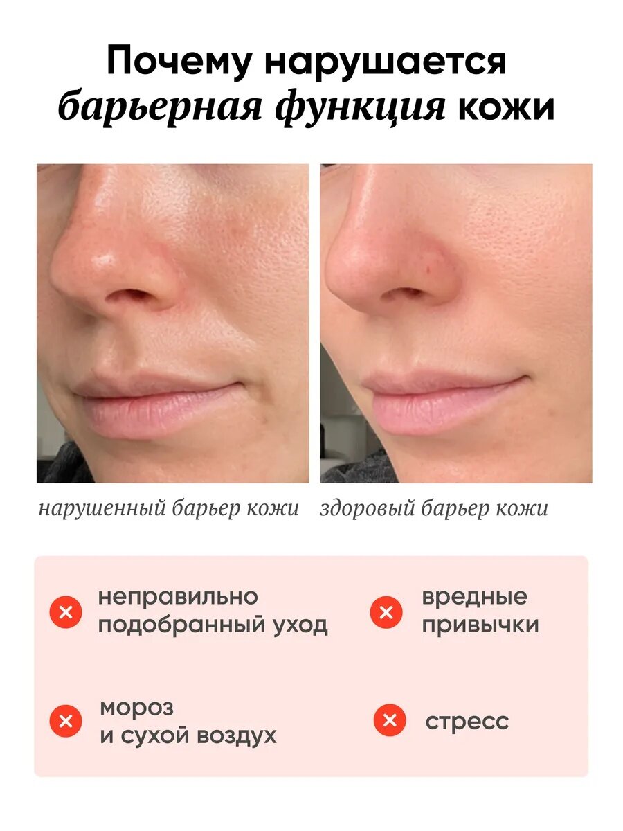 Крем для лица с ретинолом и церамидами 0,1%, антивозрастной, омоложение, сыворотка для лица от морщин, Ретинайт, 50 мл — фото 1