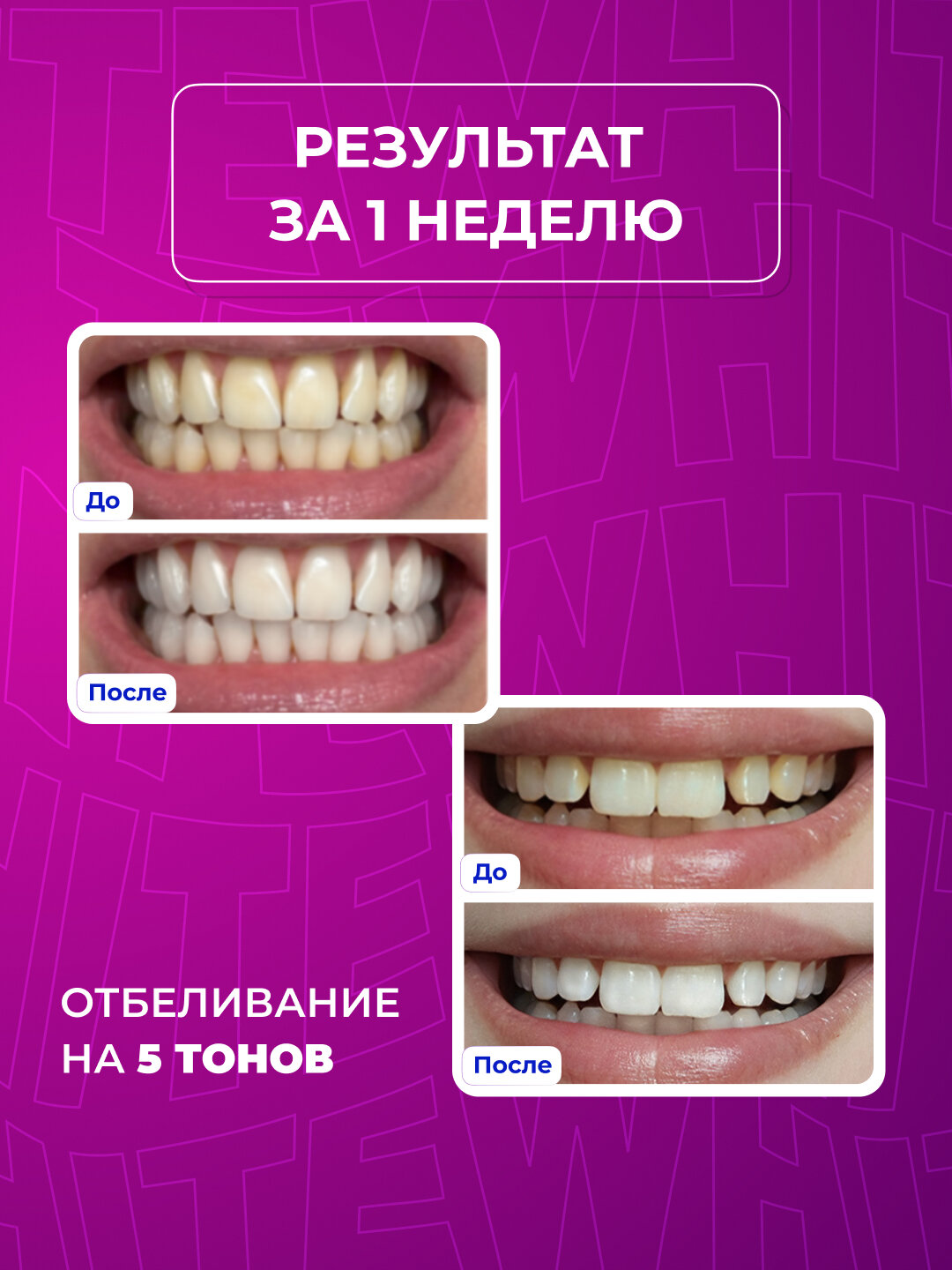 Полоски для отбеливания GLOBAL WHITE "Teeth Whitening", 1 саше — фото 1