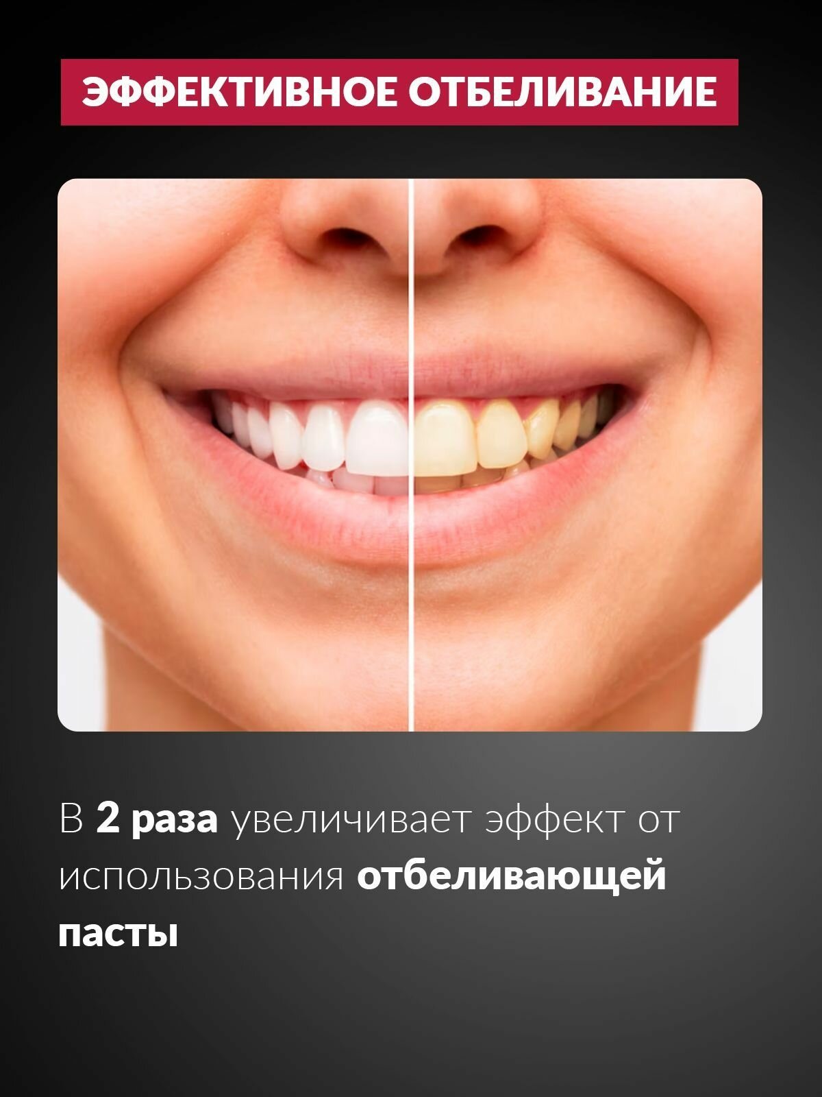 Изображение Система отбеливания зубов