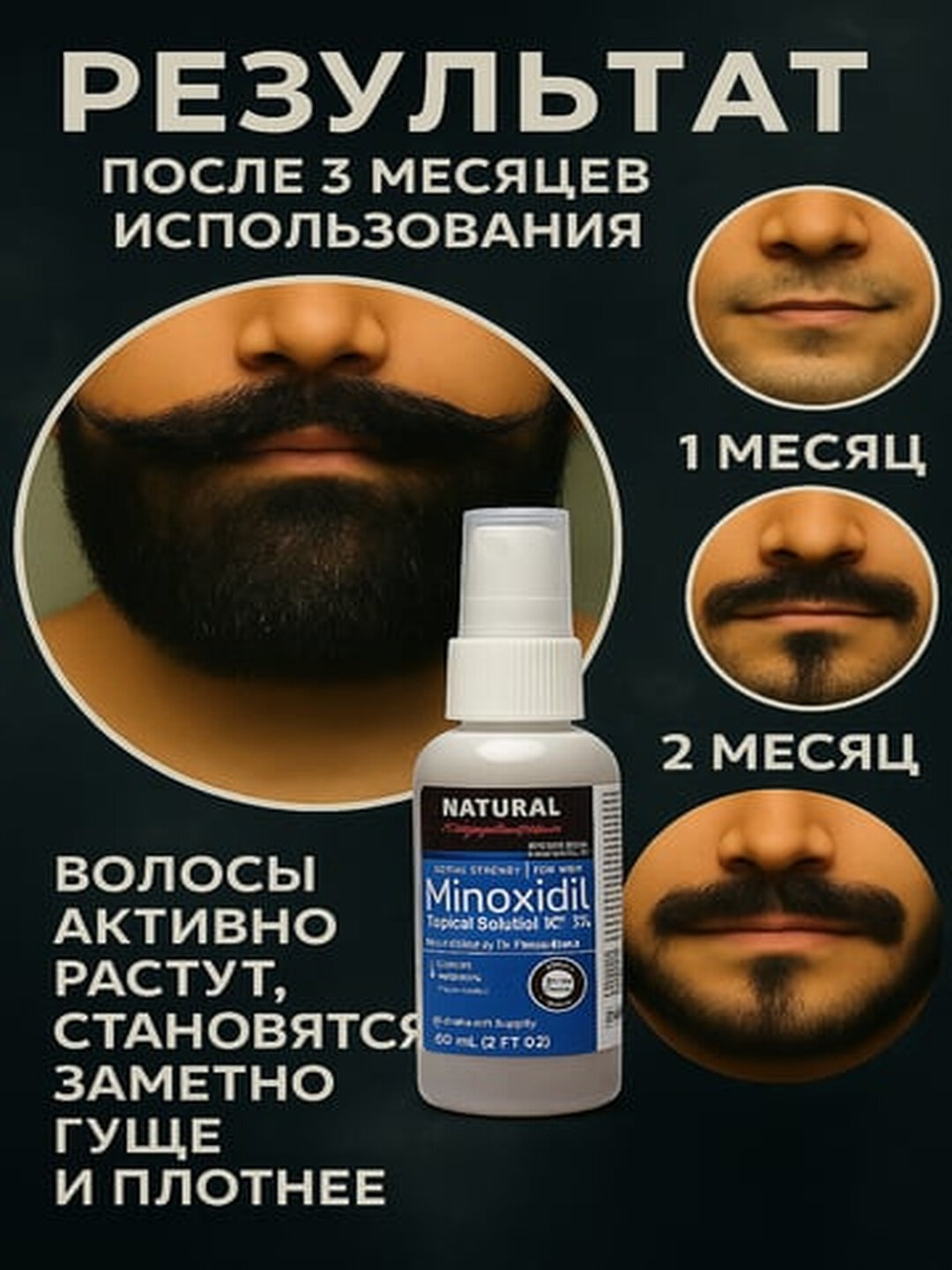 Миноксидил для роста волос и бороды Minoxidil 5%, 60 мл EAST MOON — фото 1
