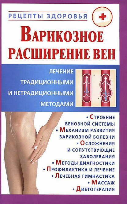 Варикозное расширение вен Лечение традиционными и нетрадиционными методами Цифровая книга