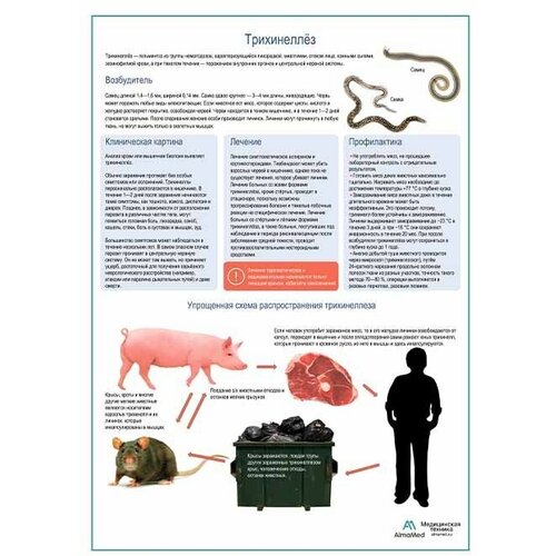 Трихинеллёз медицинский плакат А1+/A2+ (глянцевая фотобумага от 200 г/кв. м, размер A1+)