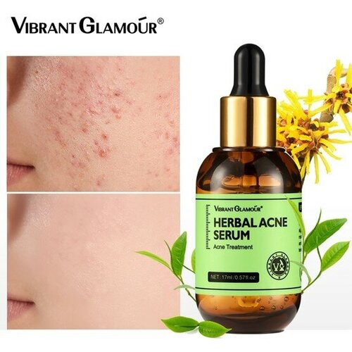 VIBRANT GLAMOUR травяная эссенция от прыщей 17 мл VIBRANT GLAMOUR Herbal Acne Essence 17ml