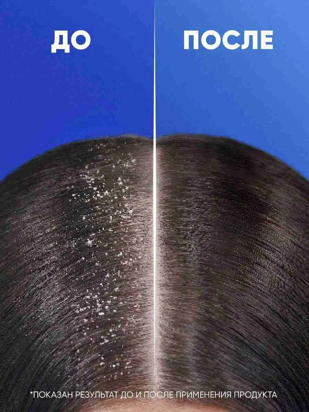 Шампунь Head&Shoulders "Цитрус Свежесть", против перхоти, для всех типов волос, 200 мл — фото 1