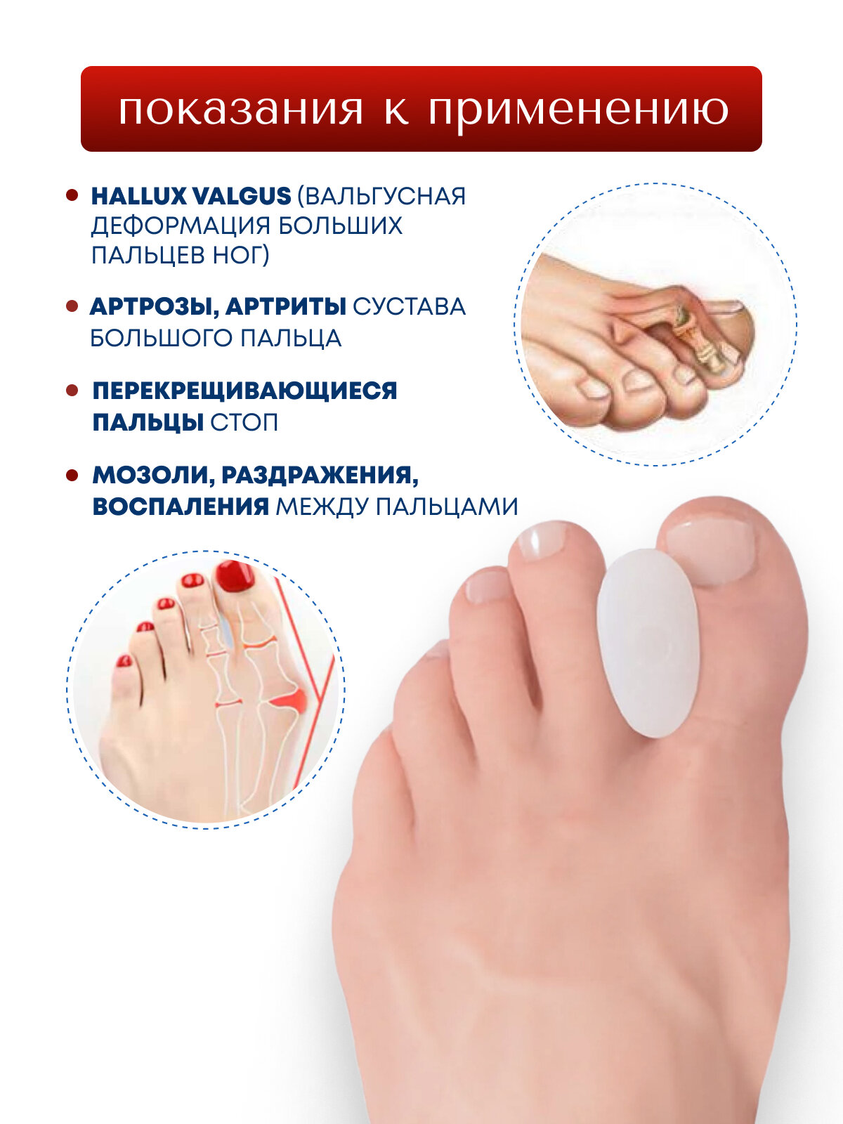 Картинки Разделитель для пальцев MyBalance, при деформации пальцев, белый, силиконовый, 2 шт, размер L