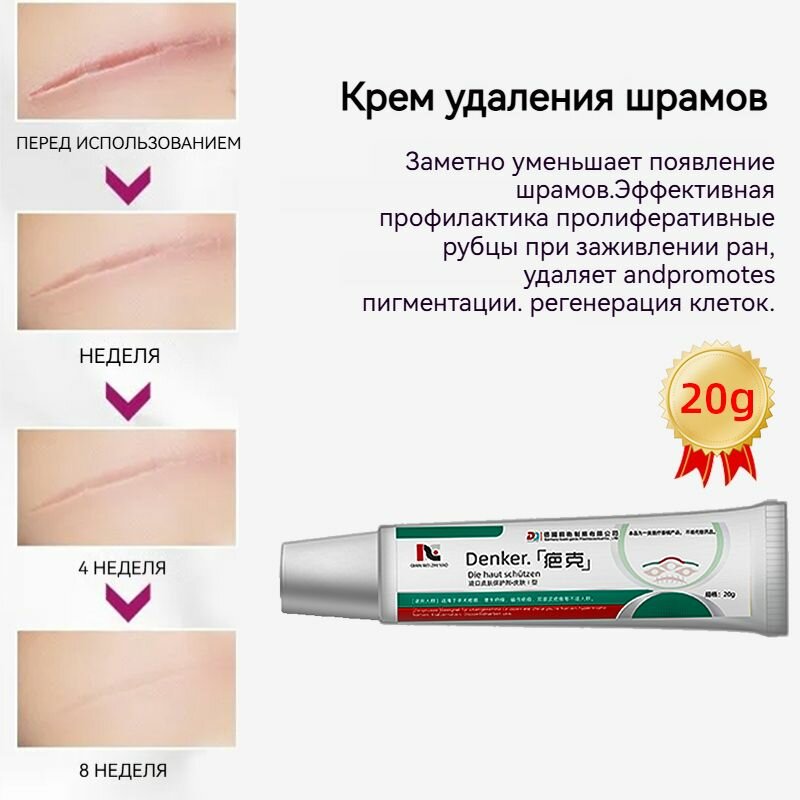Картинки Немецкий Крем от шрамов и рубцов, 20 г, гель от прыщей на лице, мазь против ожогов и пигментных пятен и теле, средство от постакне
