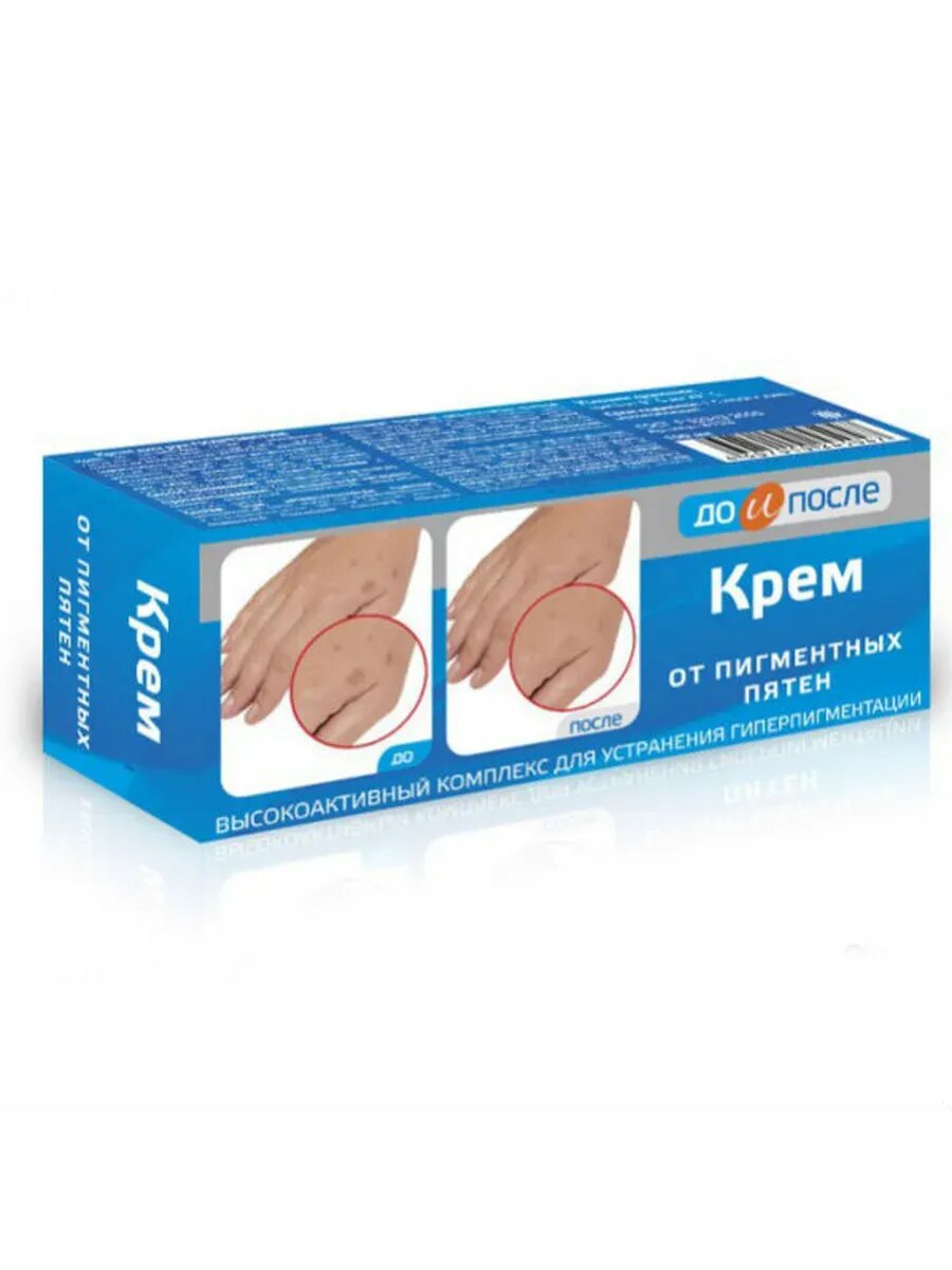 До и После Крем от пигментных пятен 50 мл 1 шт