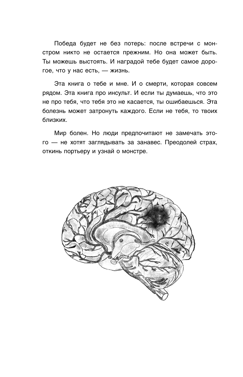 Внутри сосуда. История о скрытых возможностях мозга и чудесах нейропластичности - фото №14