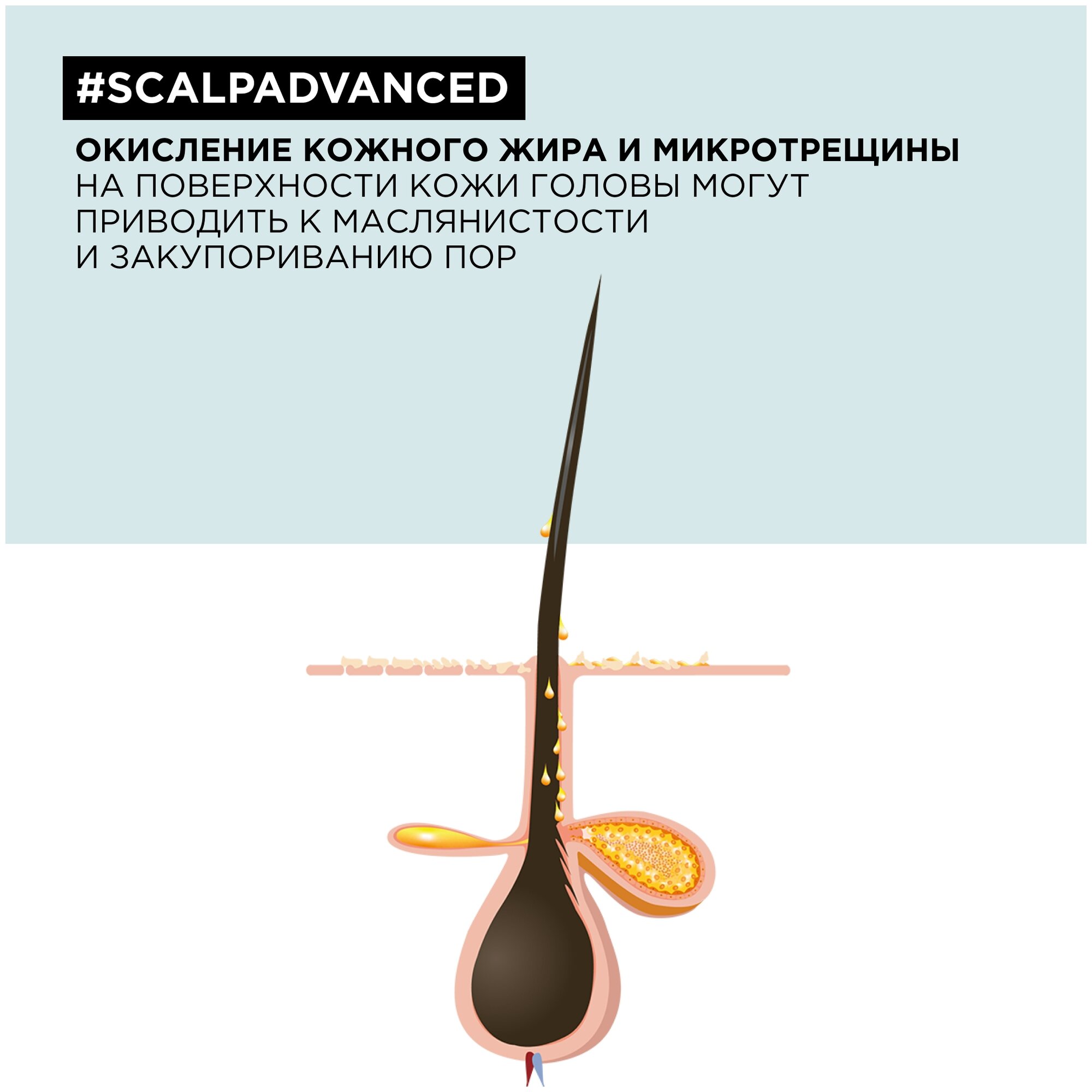 Шампунь LOREAL PROFESSIONNEL Scalp Advanced для жирных волос, 500 мл - фотография № 7