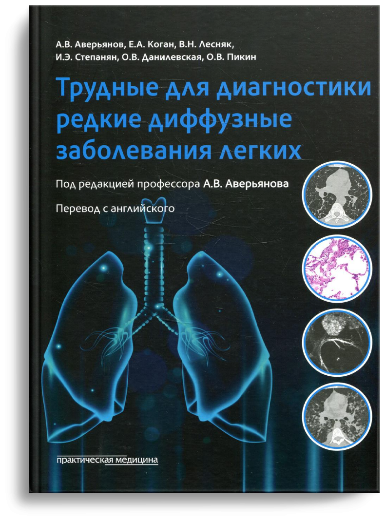 Трудные для диагностики редкие диффузные заболеваниях легких - фото №1