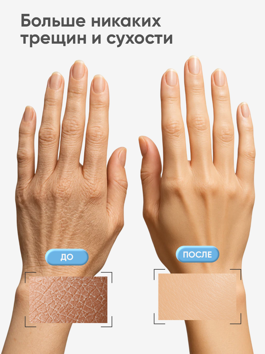 Cosmolex / Крем для рук подарочный набор 5 штук — фото 1