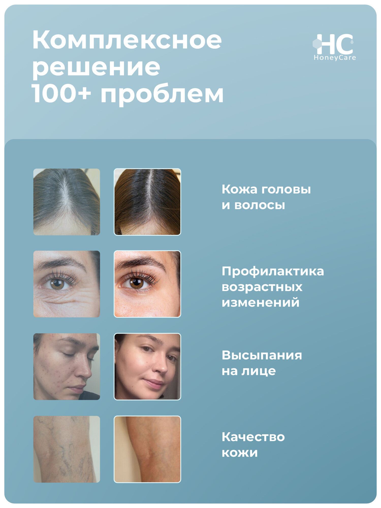 Аппарат Дарсонваль Honey Care Argon для волос, от морщин, для лица и для тела. Профессиональный уход в домашних условиях — фото 1