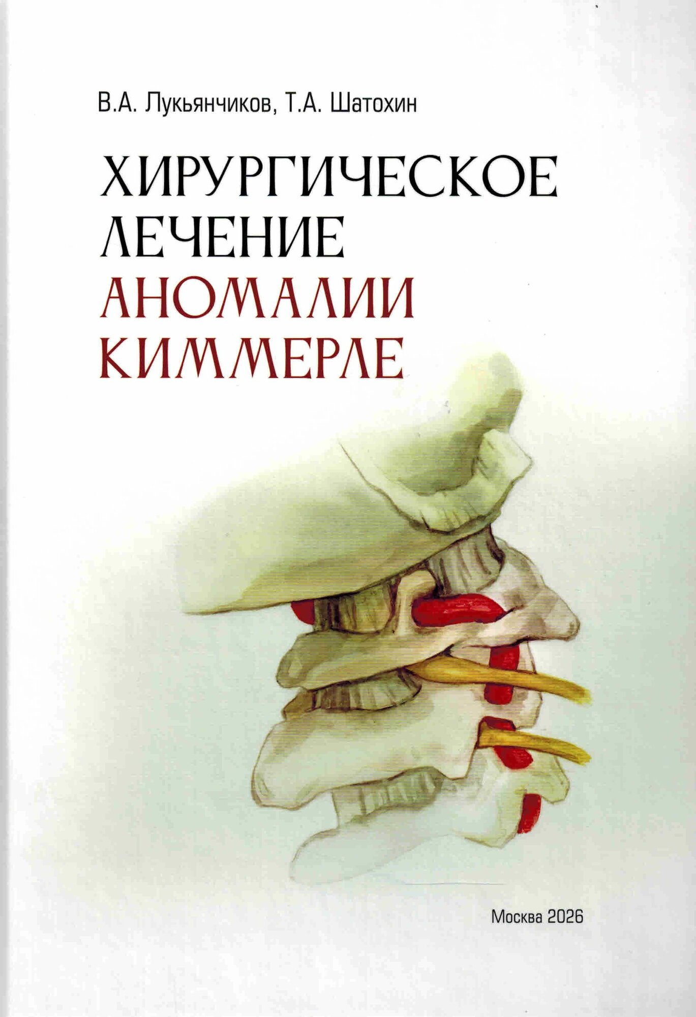 Хирургическое лечение аномалии Киммерле