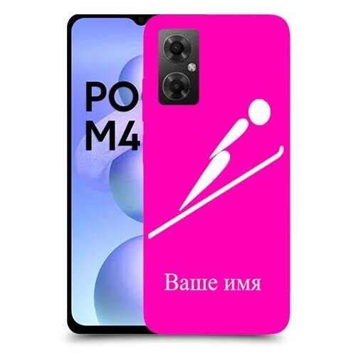   Xiaomi Poco M4 5G          