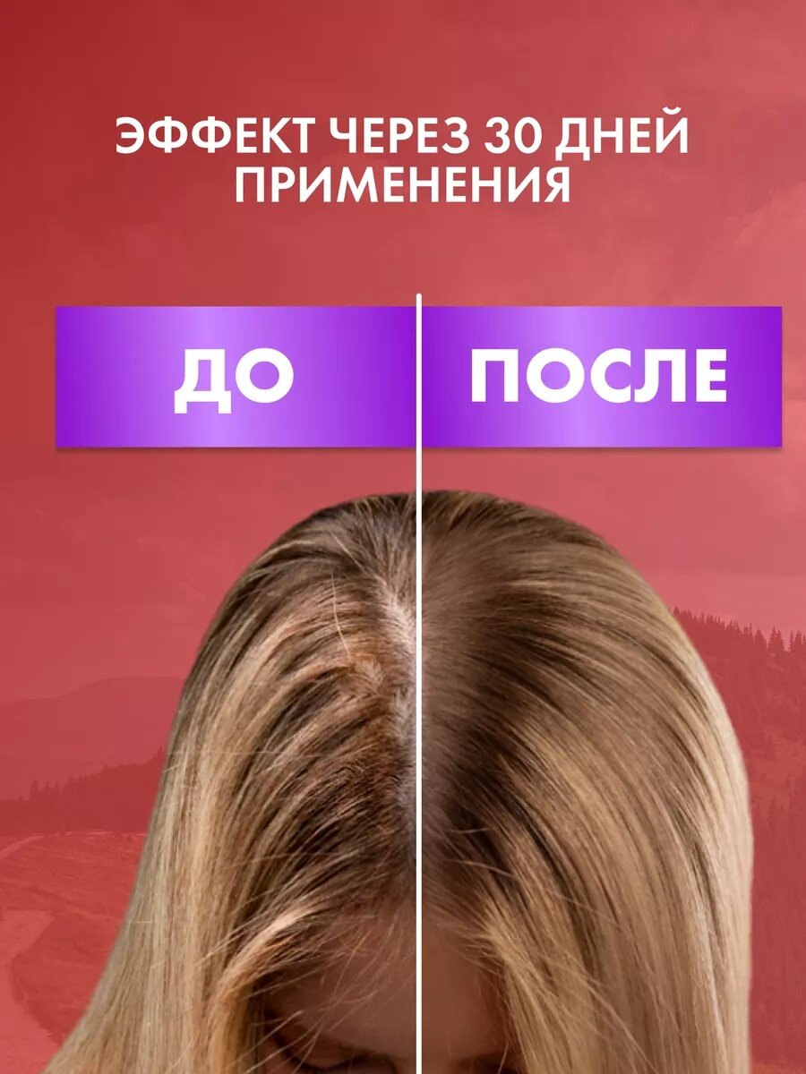 Сыворотка Floresan Ф-84 "Репейник", против выпадения волос, 100мл — фото 1