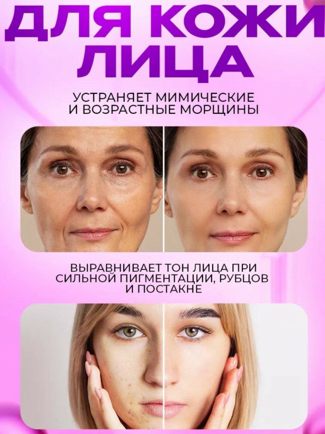 Дермороллер для усиления действия миноксидила Derma roller system — фото 1