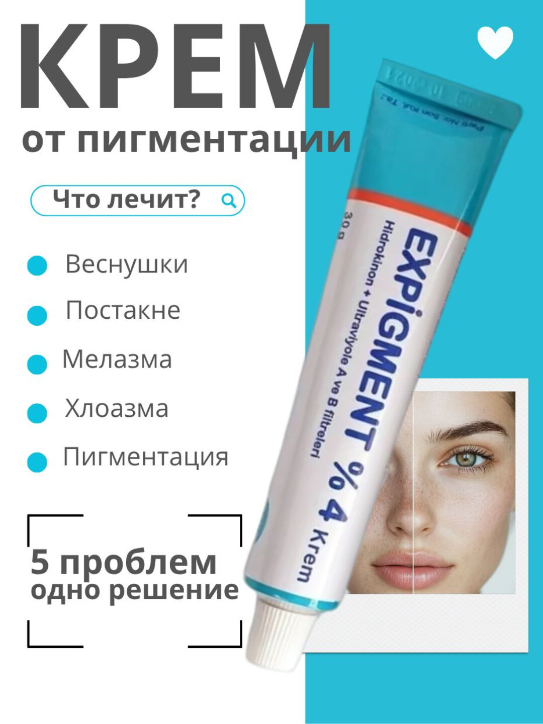 Expigment – крем для осветления кожи и уменьшения пигментных пятен»
