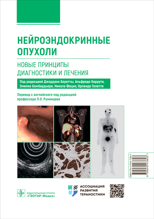 Нейроэндокринные опухоли. Новые принципы диагностики и лечения : руководство для врачей