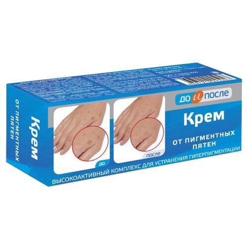 До и После (крем п/пигмент.пятен 50мл)