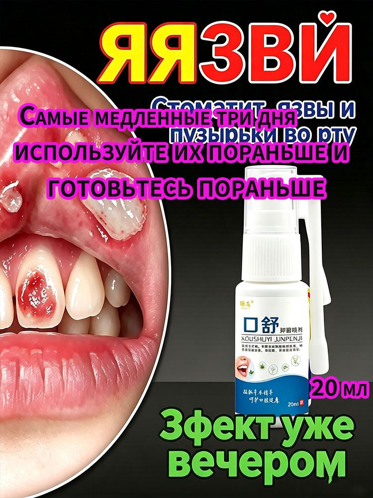 Язва в рту, 20 мл от заживляющий, стоматита и афты, противовоспалительный, обезболивающий, уничтожает бактерии, восстанавливает слизистую