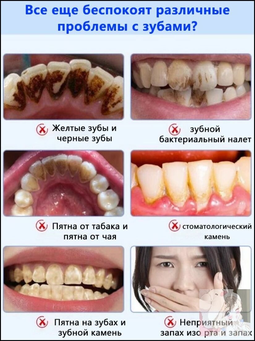 Зубная паста Лизоцим 120г термическая 39 растворяет зубные пятна отбеливает зубы освежает дыхание и удаляет налет
