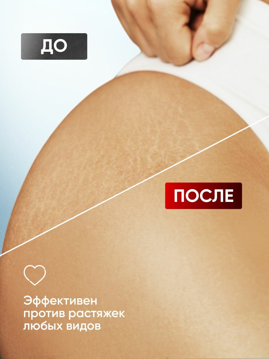 Антицеллюлитный крем гель для тела от целлюлита Алтея 250 мл — фото 2