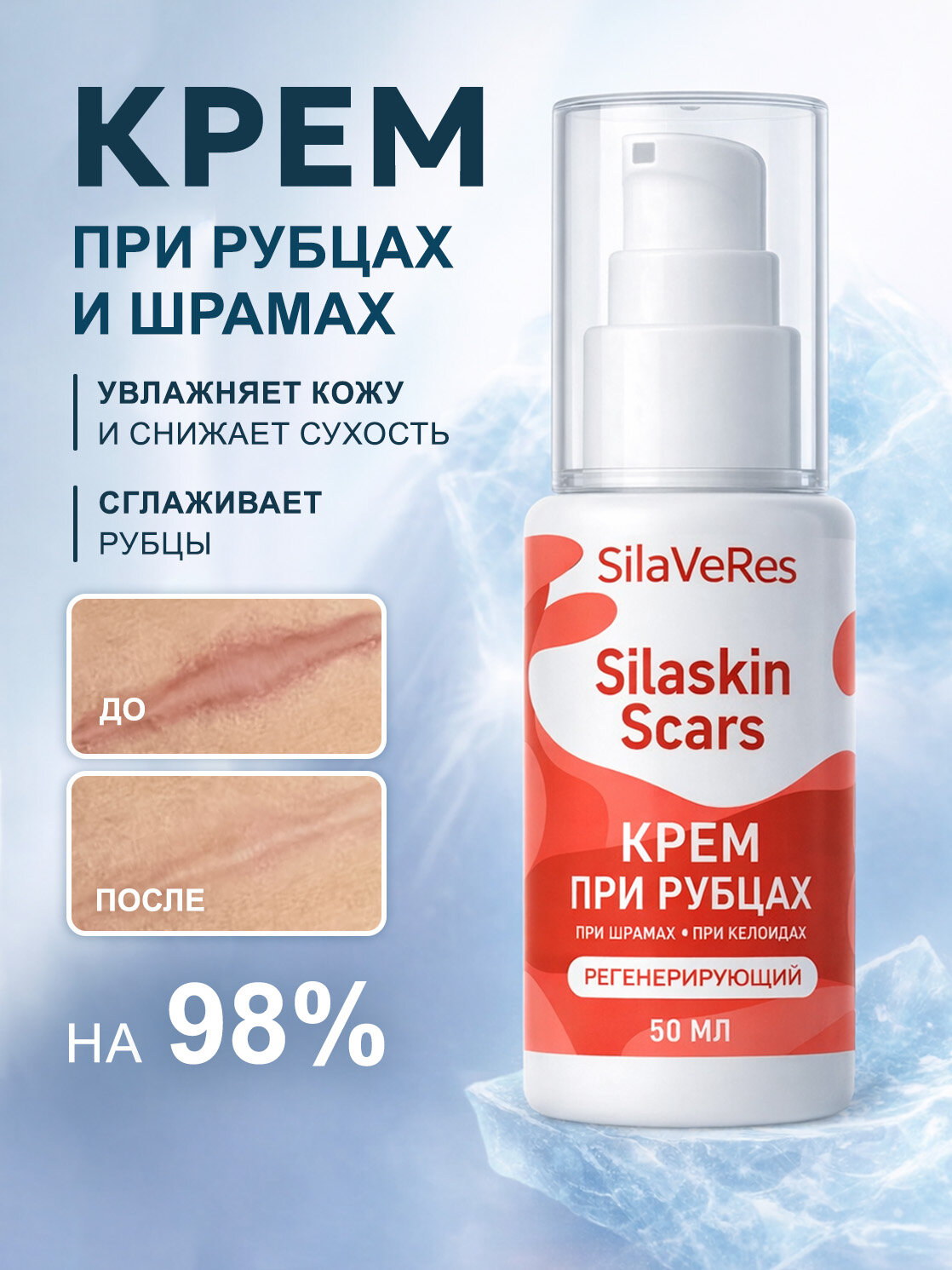 Крем регенерирующий SilaVeRes, от шрамов, рубцов и темных пятен, 50 мл