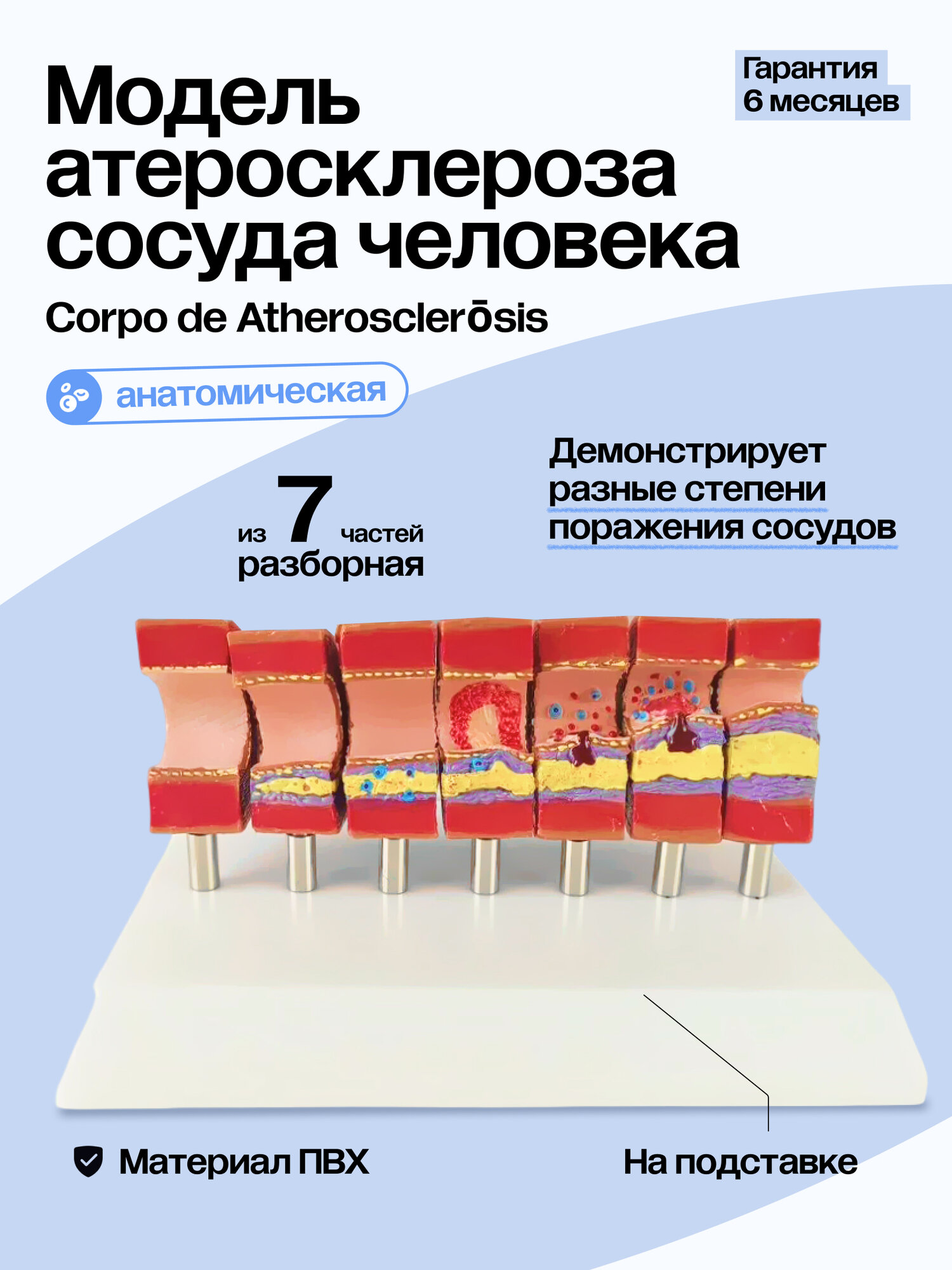 Разборная анатомическая модель атеросклероза сосуда Corpo de Atherosclerōsis