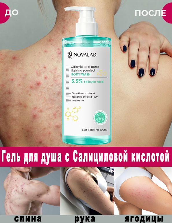 Гель для душа с салициловой кислотой 400 мл, Интенсивная борьба с высыпаниями, Очищение пор, Снижение воспалений, Подходит для ежедневного использования.