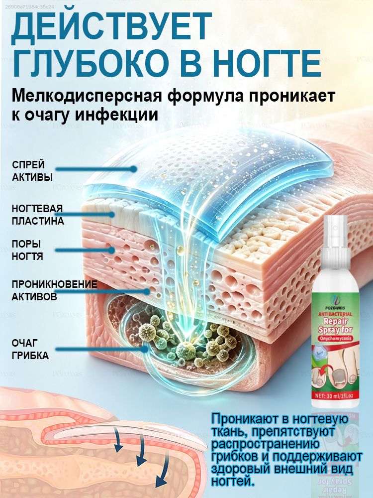 Спрей от грибка ногтей с мощным противогрибковым действием, проникает глубоко, устраняет запах, восстанавливает