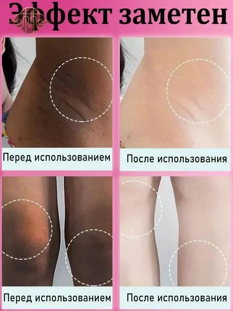 Твердое мыло — фото 1