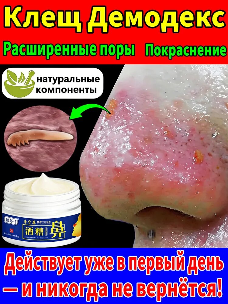 Мазь от акне и демодекоза на лице с ниацинамидом30r