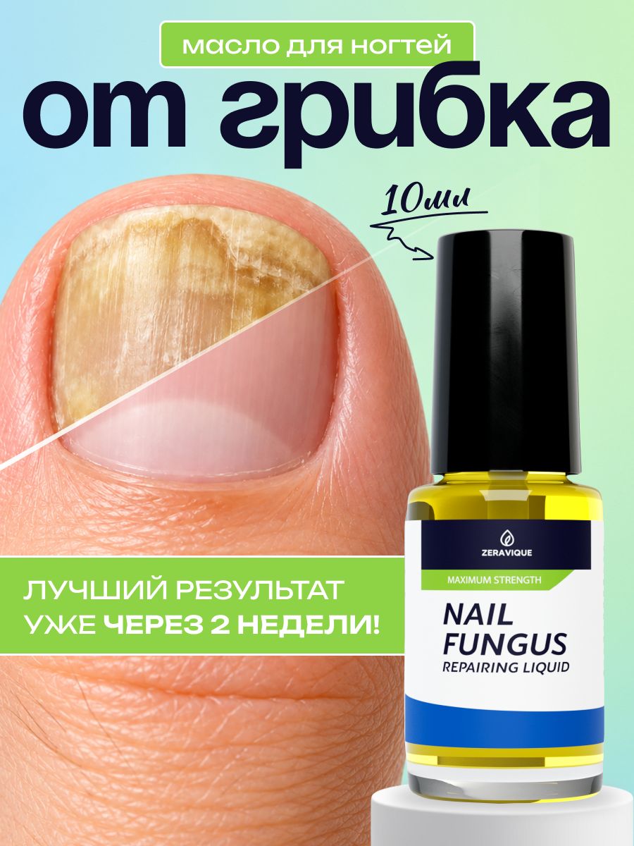 Масло от грибка ногтей, эффективное средство от грибка ногтей на ногах и руках, Nail, стоп онихолизис