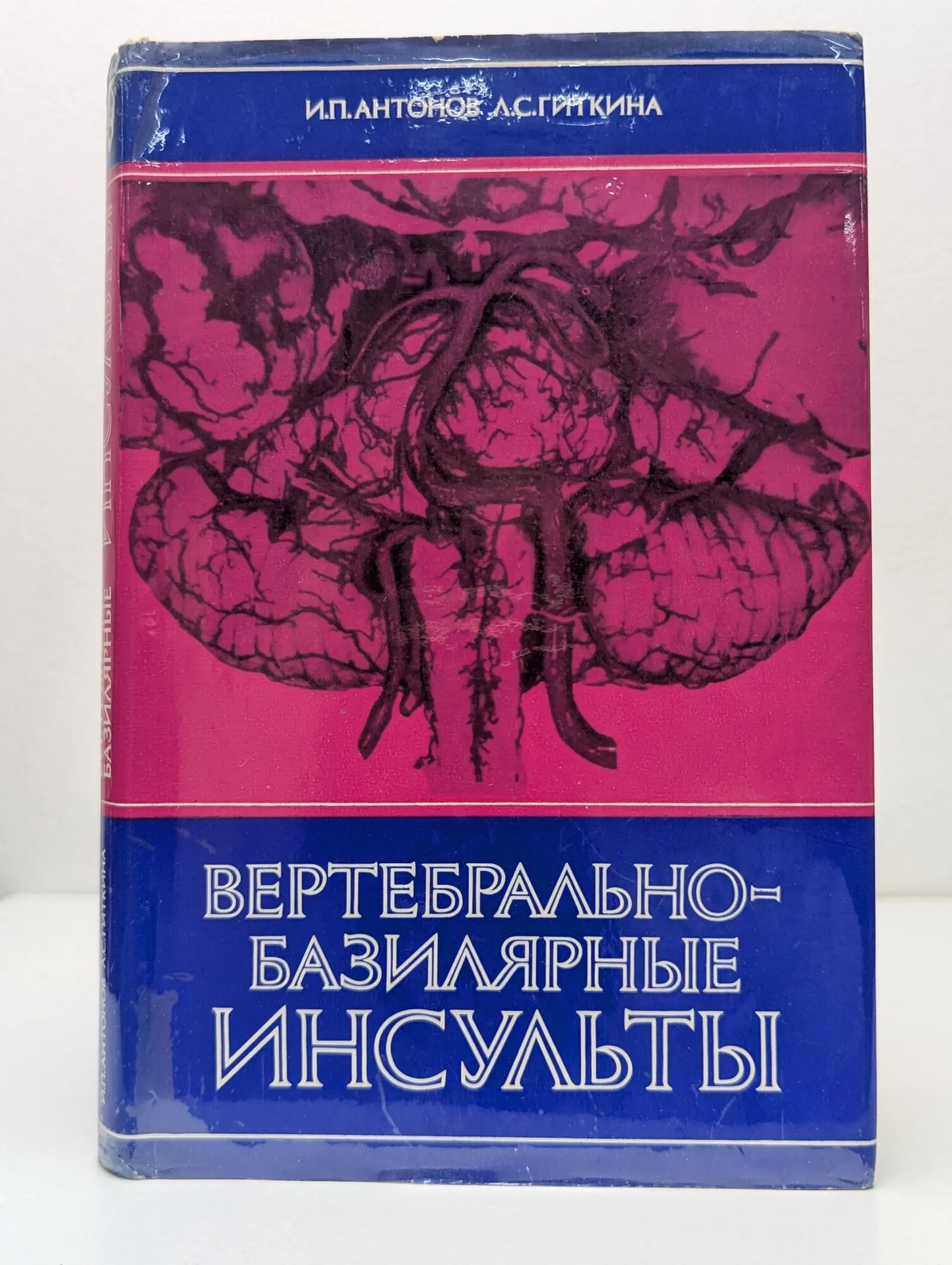 Вертебрально-базилярные инсульты Антонов Игнатий Петрович, Гиткина Леонора Семеновна 1977