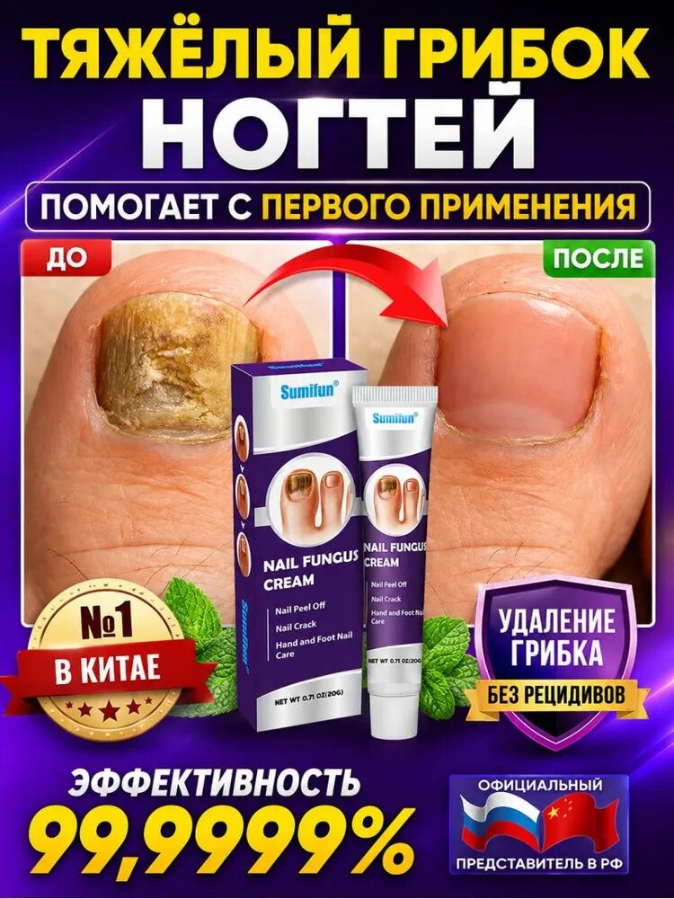 Крем для лечения онихомикоза используется для лечения грибковых инфекций ногтей. Лечит грибковые инфекции, укрепляет и восстанавливает ногти и роговой слой кожи.