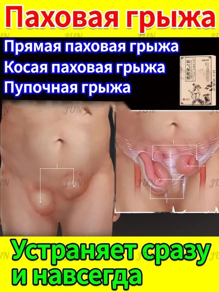 Пластырь для лечения паховой грыжи у мужчин при болях и дискомфорте
