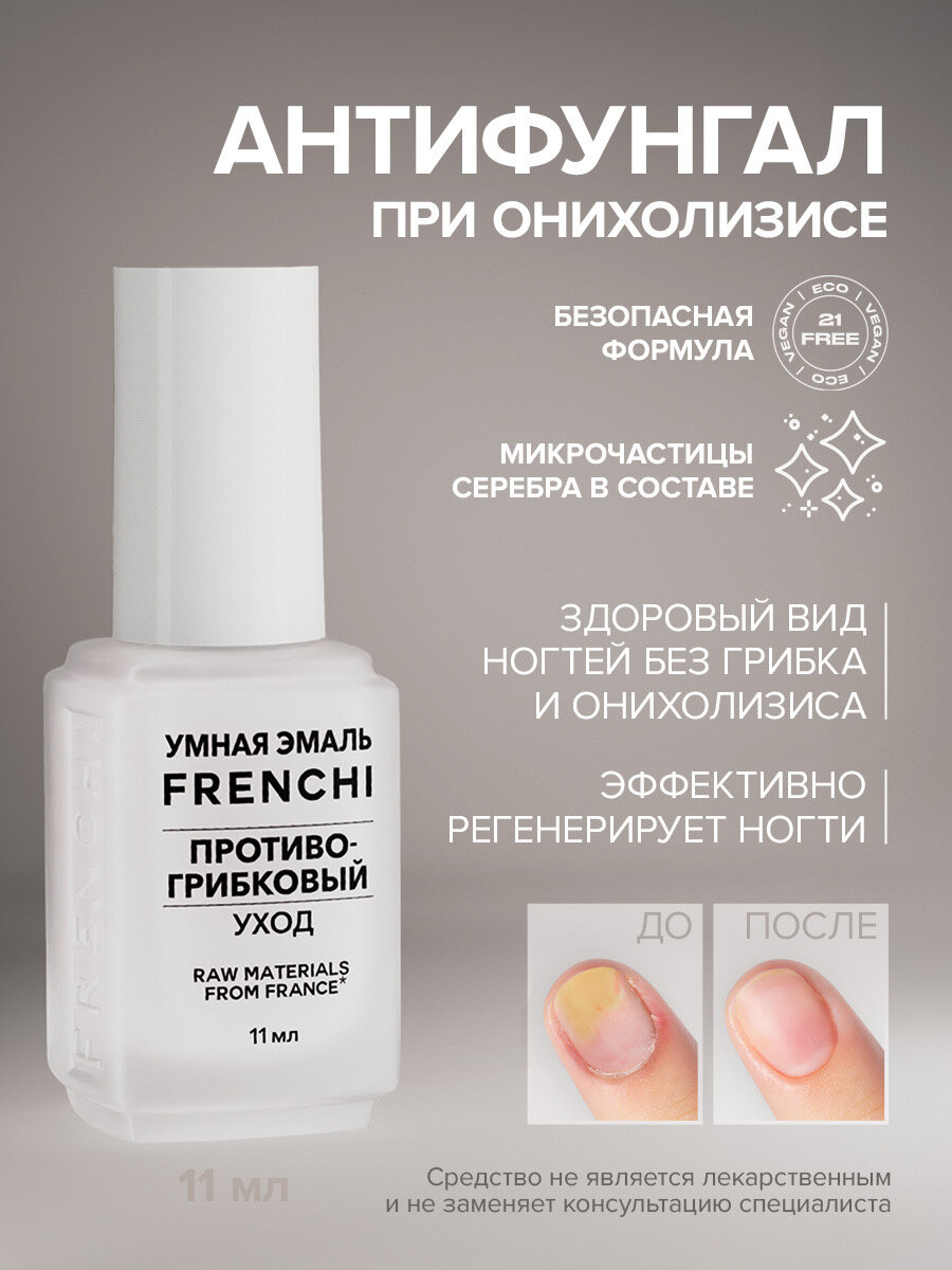 Антифунгал лак для ногтей противогрибковый уход для взрослых и детей FRENCHI Умная Эмаль  11 мл.