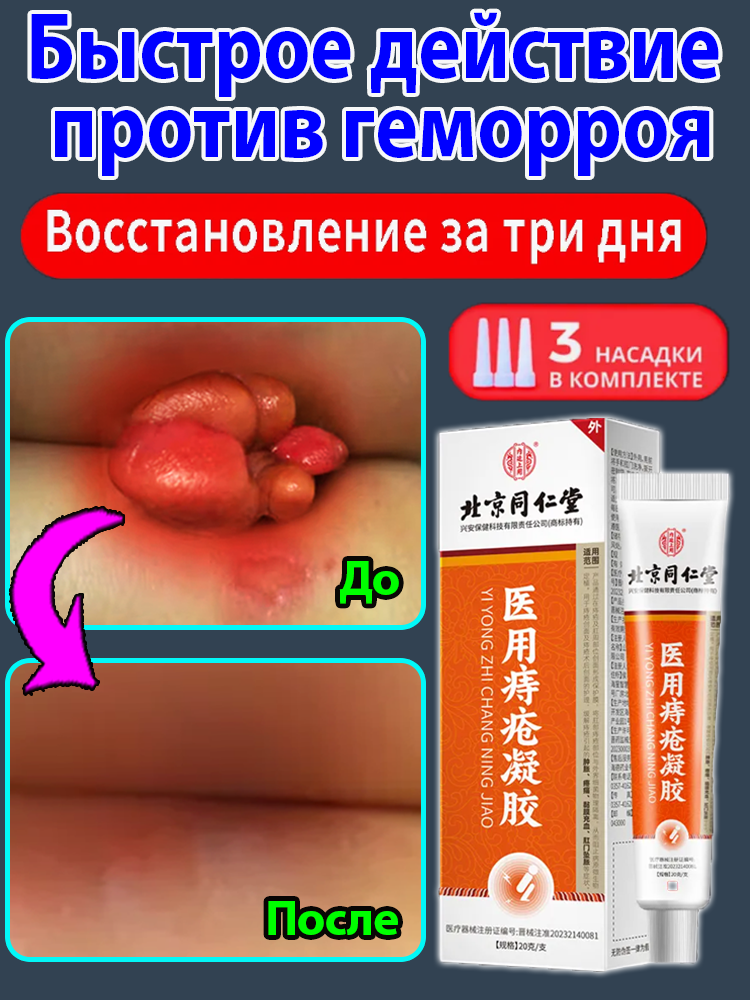 Мазь от геморроя китайская боль отек анального отверстия и другие симптомы вызванные геморроем