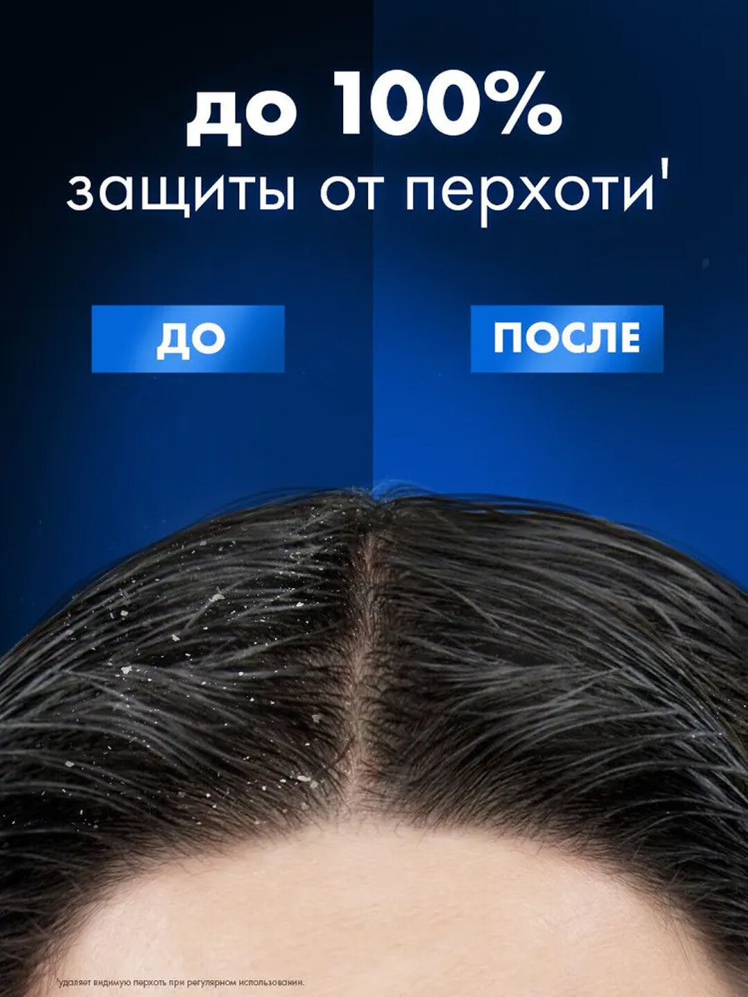 Шампунь Clear "Энергия свежести", для мужчин, против перхоти, 380 мл — фото 1