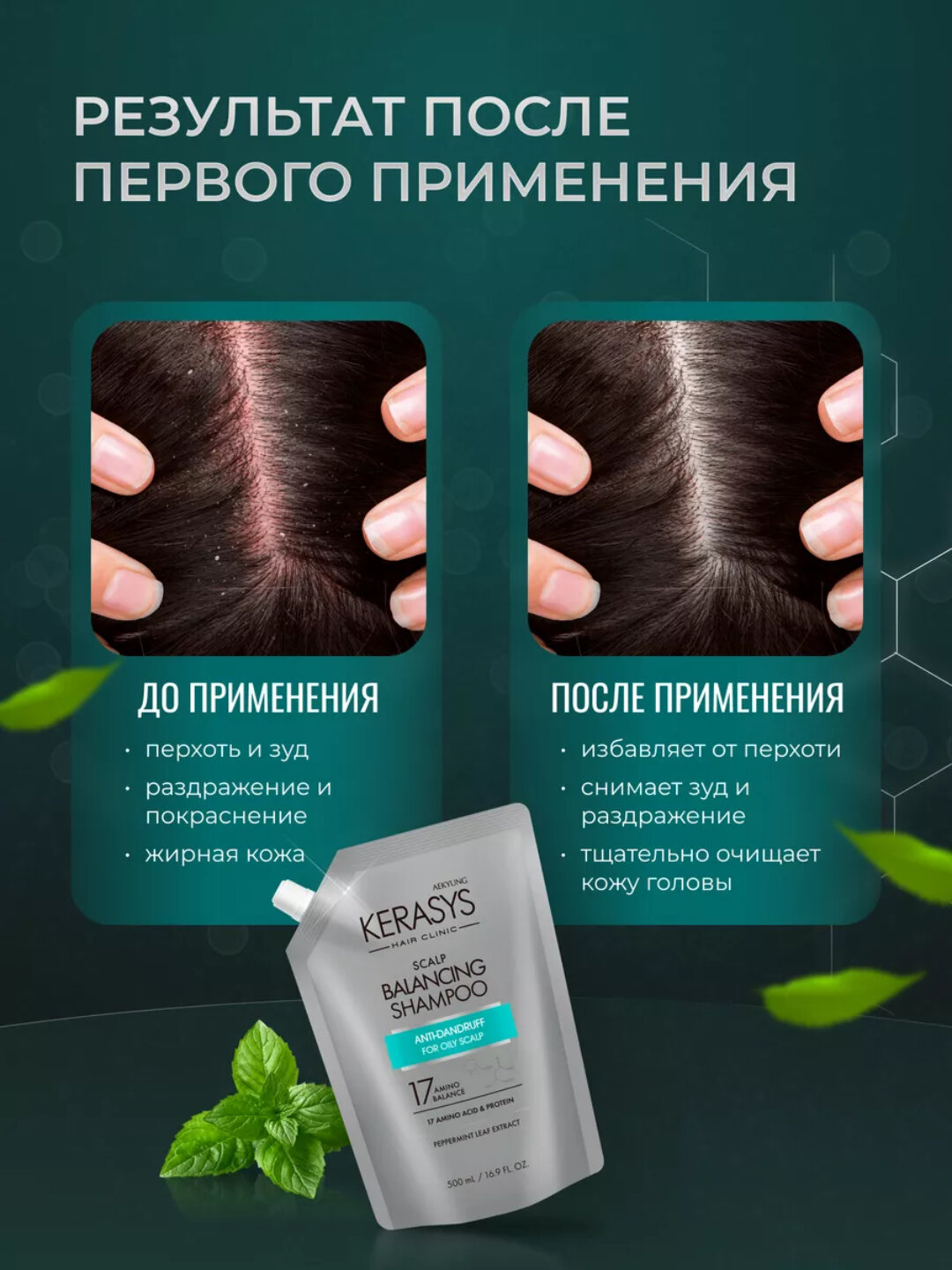 Шампунь против перхоти Kerasys Scalp Balancing для жирных волос, с кератином — фото 1