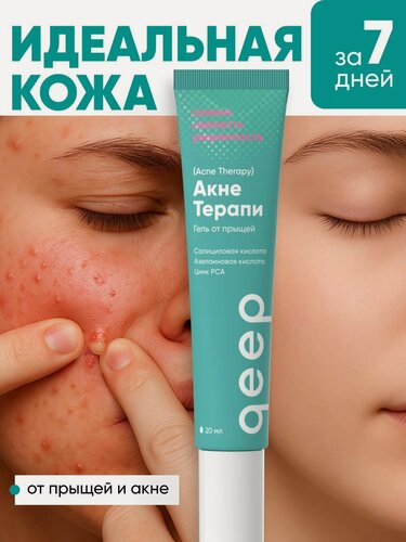 Изображение товара Крем корректор точечный от прыщей и акне, крем-гель для проблемной кожи, салициловая кислота, Qeep 20 мл