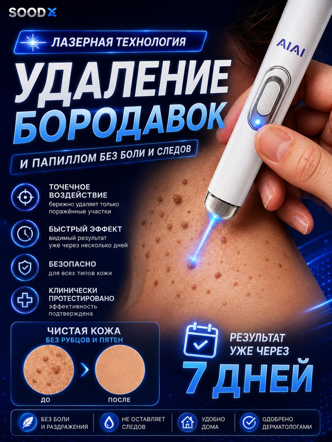 Прибор для удаления бородавок с синим светом, ручка для папиллом и локальных образований кожи, для рук и стоп, домашний