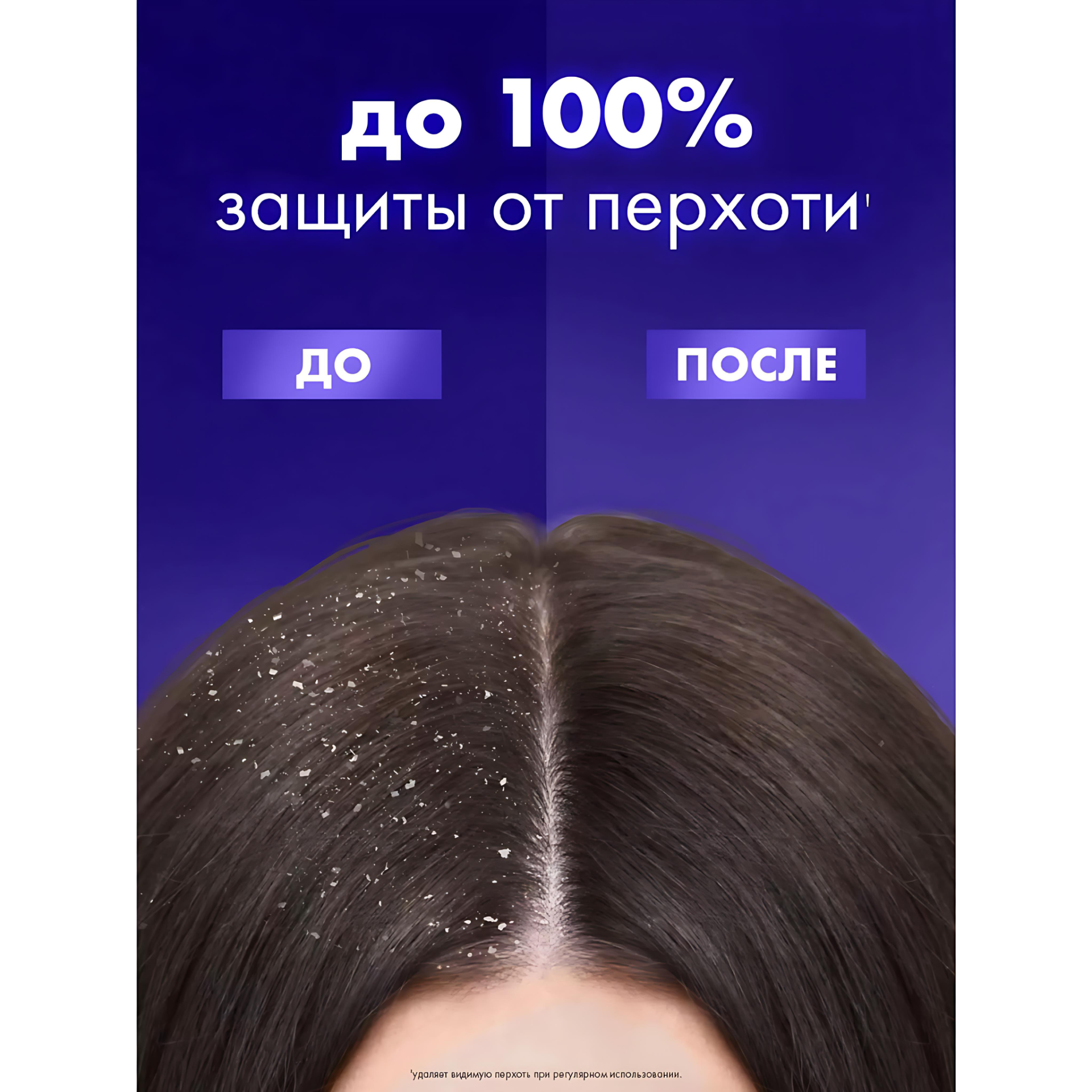 Clear шампунь для волос женский от перхоти, 400мл. Аромат: Максимальный объем — фото 1
