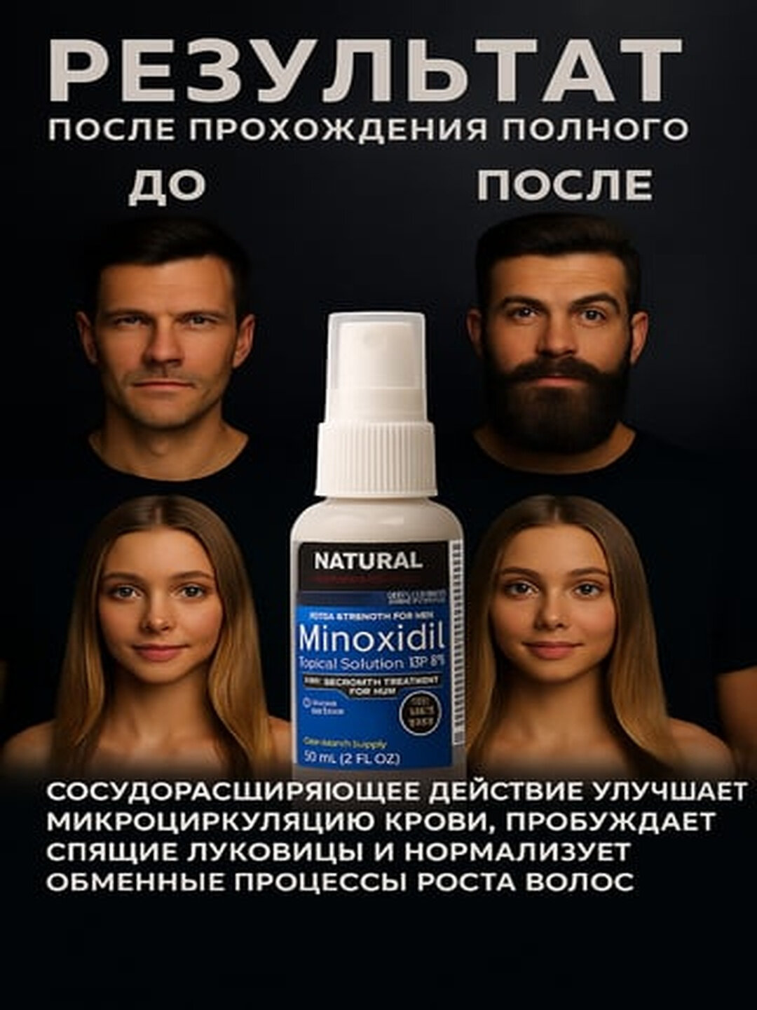 Миноксидил для роста волос и бороды Minoxidil 5%, 60 мл EAST MOON