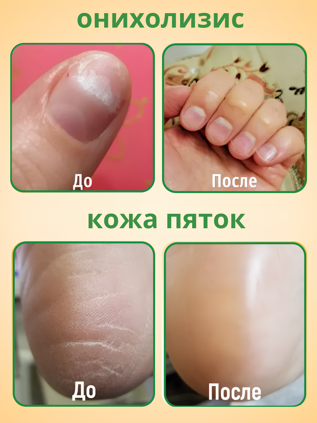 Масло монарда, для ногтей, укрепление, противовоспалительный эффект, 30 мл — фото 1